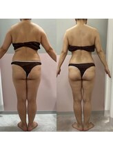 エクラ(Eclat)/Eclatの痩身★BeforeAfter2