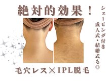 エステティック レイビス 銀座店(RAYVIS)/