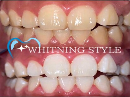 ホワイトニングスタイル 柏店の写真