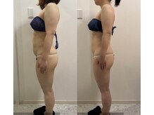 モア 鈴鹿(more)の雰囲気（【痩身&筋膜リペア】で痩せながらコリ解消◎痩せやすい身体作り）