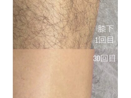チル(chill)の写真