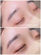 ヨリソイ(yorisoi)/HBL