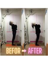 みずき整骨院 骨盤本舗/BEFOR/AFTER