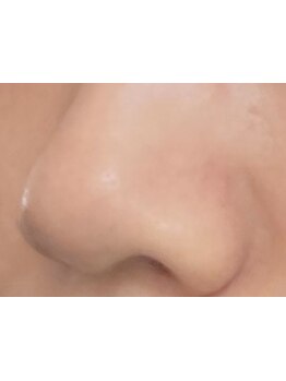 毛穴ケアをしたい