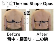アネラ(ANELA)の雰囲気（15号→11号へサイズダウン食事制限無・運動無・サプリ無）