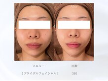 ベレガ 大阪本店(BELEGA)/◆ビフォーアフター◆