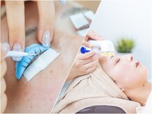 アーキ(ARCHI)の雰囲気（【稲沢/国府宮】エステとアイラッシュ、同日施術も可能です☆）