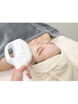 顔脱毛がしたい