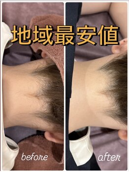 アイリビューティー専科(AIRIビューティー専科)の写真/◆地域最安値◆【初回/全身脱毛¥5500】最先端脱毛マシン&ヒアルロン酸保湿仕上げで最短で全身ツルスベ肌♪