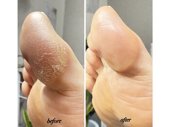 ラヴィ(La vie)/かかとはキレイだけどここが