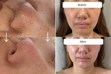 シェリー(cherie)