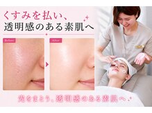 メモリ