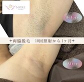 モアトゥインクル 五日市駅前店(MORE twinkle)