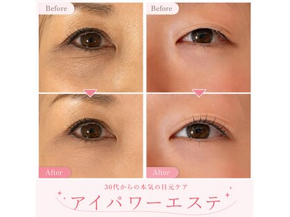 is Beauty | 足利/まつげ/ネイル/エステの写真