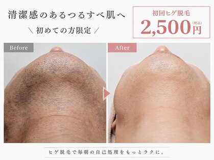 オレオマ(OLEOMA)の写真