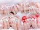 ユリネイル(Yuri nail)の写真