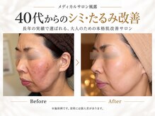 メディカルサロン 風露