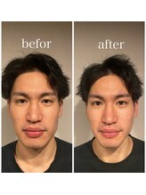 グレースフィオーレ 町田店(gracefiore)/ビフォーアフター/施術1回の効果