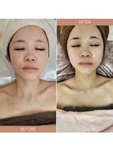 ティックサロン(tic.salon)/ハーブ＆タラソトリートメント