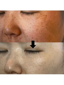 ザ シー タイムレスビューティ(THE SHE)/シミを改善!肌にハリと明るさ◎