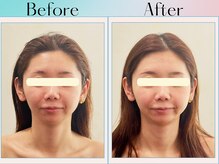 天空の手もみ/小顔矯正/吉祥寺/荻窪/西荻窪