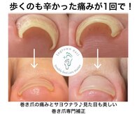 シーネイル(C Nail)