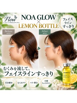 フロウ(Flow)の写真/「気になるフェイスラインに。ノアグロウ×レモンボトル」