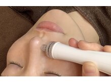 ヘラ(HERA)/ハイドラフェイシャルでたまご肌