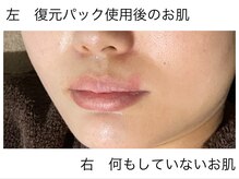 ビューティーサロン ビビ(Vivi)/復元パックが凄い！