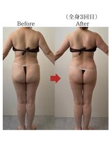 バーチュ(Virtue)/全身3回で隙間が！！