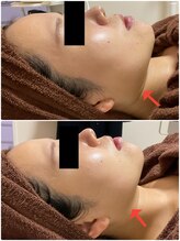 プチボヌール(petit bonheur)/お客様症例写真