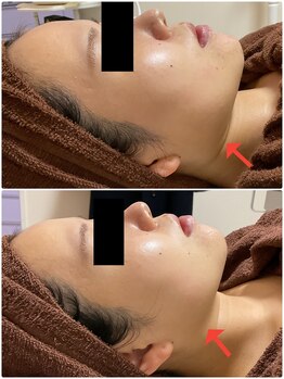 プチボヌール(petit bonheur)/お客様症例写真