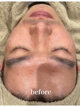 ドクターエイチ 四ツ橋堀江店(Doctor.H)/ララピール