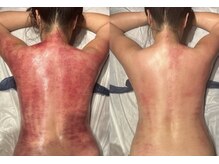 ジュエリーボディー(Jewelry body)/ブライダルエステ