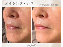 スリースリー(THREE THREE)/エイジング・しわケア