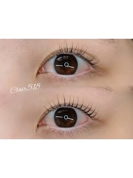 まつげのお悩み解決サロン