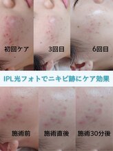 ショウナンきれいサロン 藤沢店(SHONAN) SHO NAN