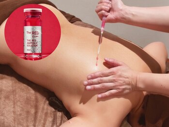 ボディ アンド フェイシャル アンジェラ(Angela)/脂肪分解剤で集中サイズダウン