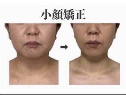 オーラ 美容サロン(AURA)の写真
