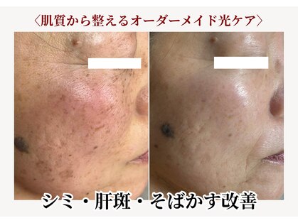 ボータン 恵(Beau Temps)の写真