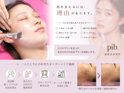 ピブ(pib.)の写真