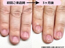 カピリナ(Ka Pilina)/自爪育成