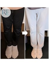 リベスト(RE:BEST)/当院の＜骨盤＋O脚矯正＞効果