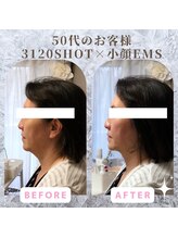 ラ セラフィータ 中目黒/【上級小顔】EMS美容液導入付き