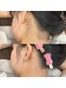 ≪全員≫ うなじワックス脱毛 ¥3500