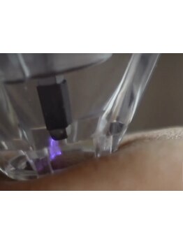 ハリツヤをUPしたい