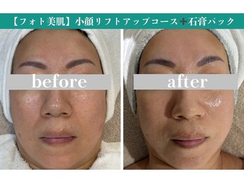 ベルスタイル(Bell style)/当店のお客様症例