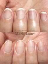 マリーロール 天王寺店(Marie Laure)/深爪矯正/自爪育成/ネイルケア/