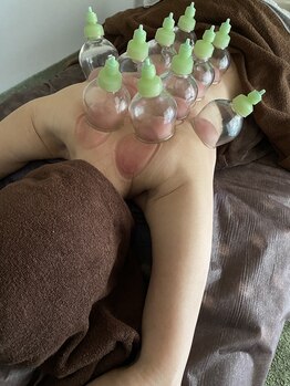 サロン零(Rei)/オプション☆カッピング