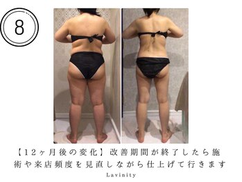 ラヴィニティ 南越谷店(Lavinity)/改善が終わったら記憶期間へ